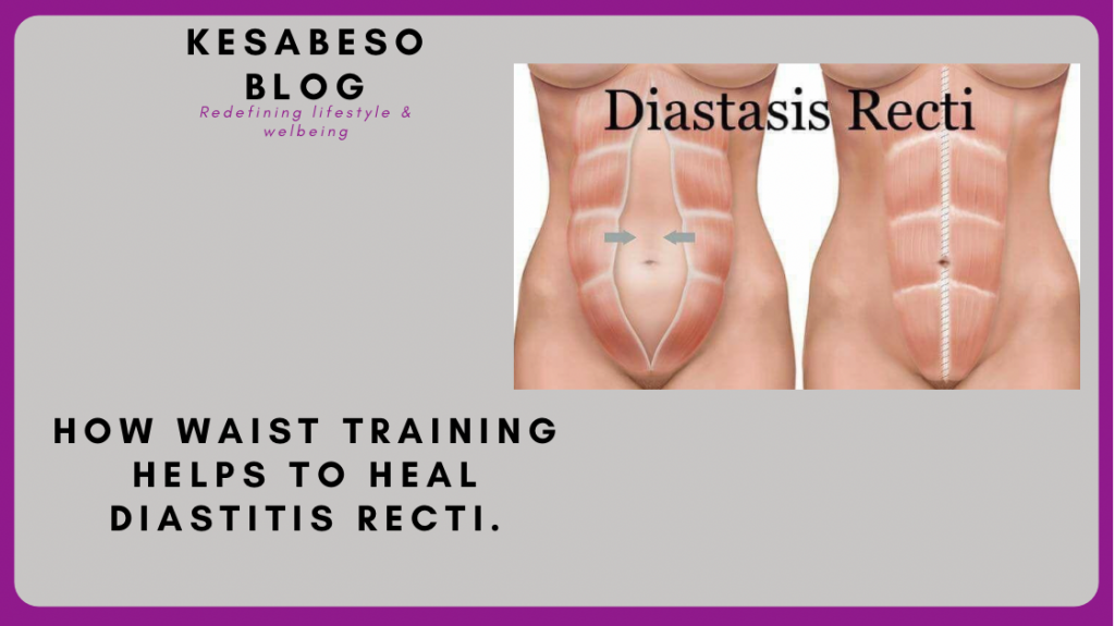 How waist training helps to heal Diastasis Recti is a benefit of waist training. Waist training goes beyond giving you an hourglass figure!